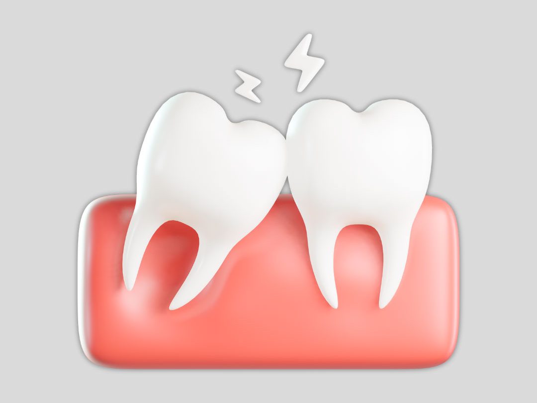 exodontia-odontologia