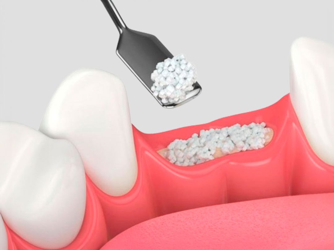 periodontia-odontologia-clinica
